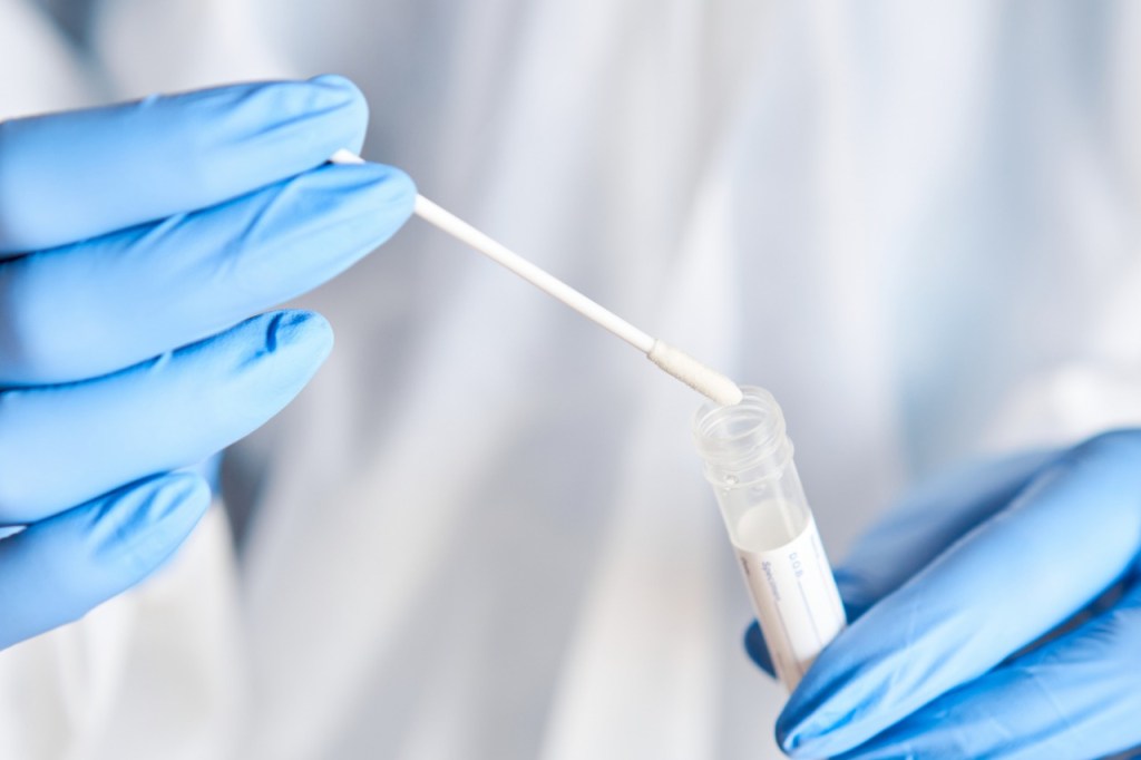 SMS Natal expande oferta de testes de Covid-19 em parceria com a&nbsp;UFRN