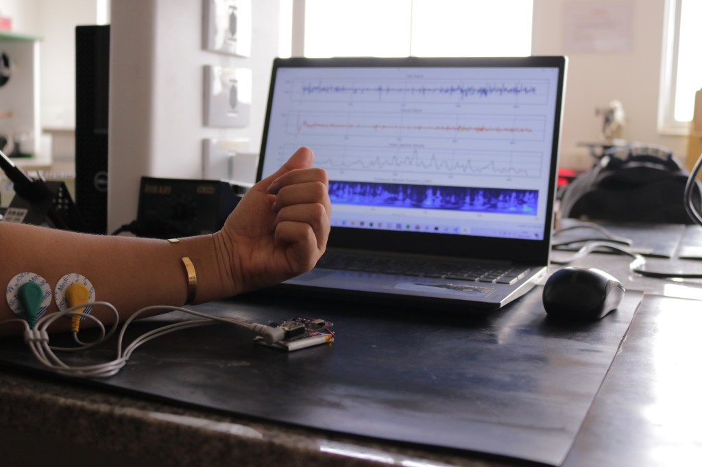 Invento potiguar voltado para diagnóstico da ELA reforça potencial da tecnologia e da inteligência artificial para a melhoria da&nbsp;saúde